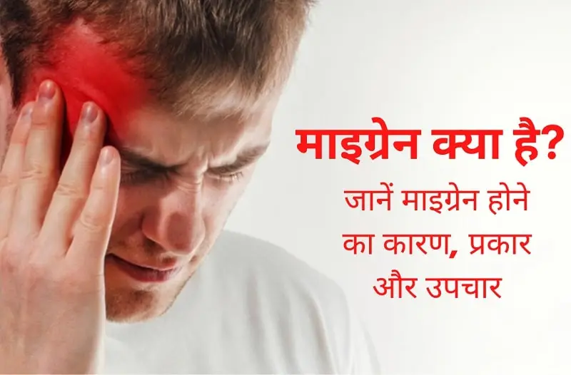 माइग्रेन (Migraine) का इलाज कैसे किया जाता है?